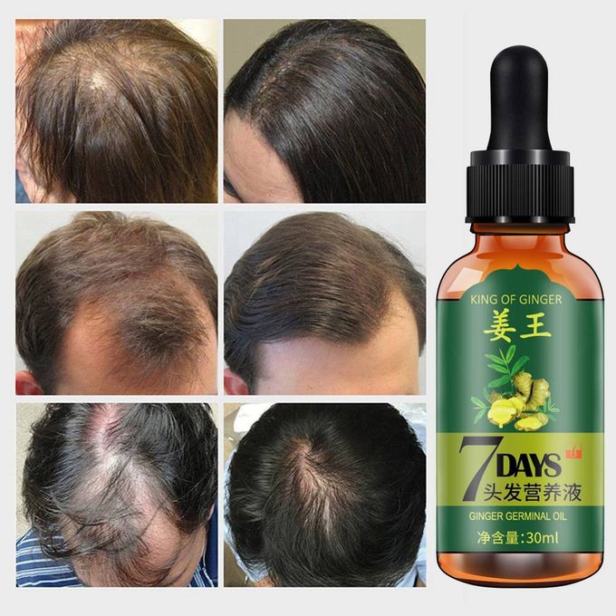 GINGER GERMINAL OIL for fast hair growth - Image 2