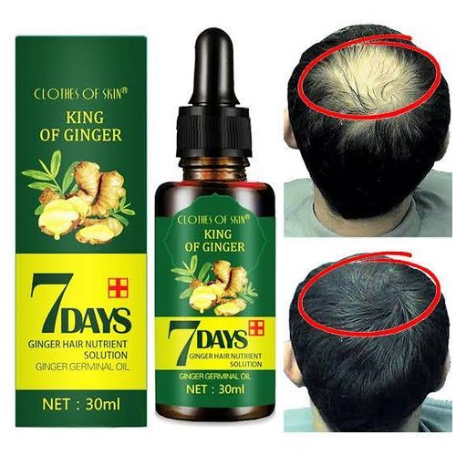 GINGER GERMINAL OIL for fast hair growth - Image 4