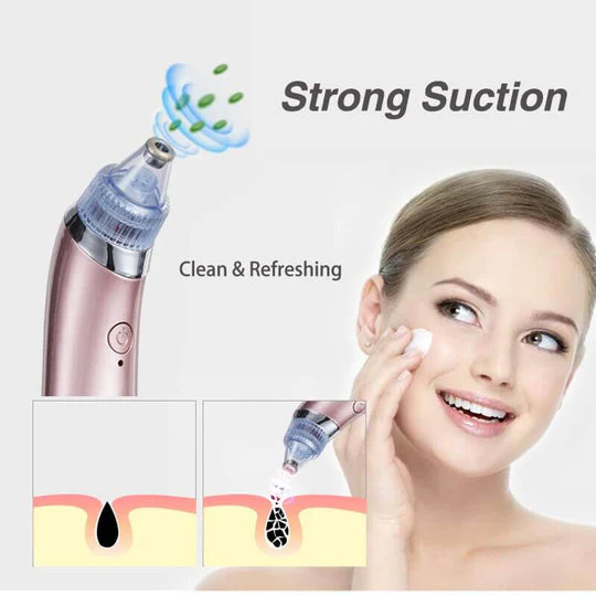 Imported Blackhead & Acne Pore Cleanser Removal kit - Image 4